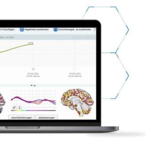 Metavital Smart balancing Module 